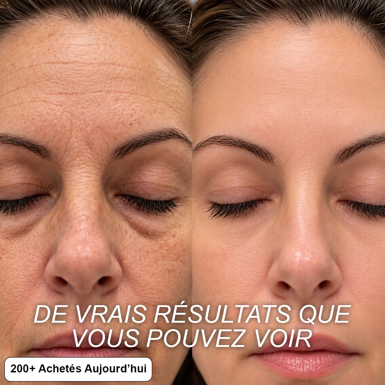 STICK REPULPANT BIO-COLLAGÈNE PDRN