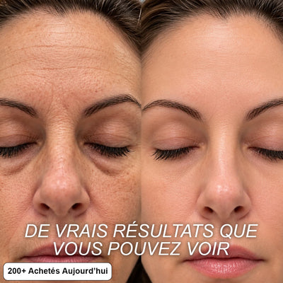STICK REPULPANT BIO-COLLAGÈNE PDRN