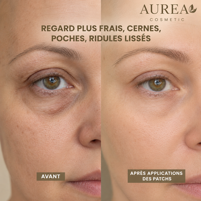 Patchs Hydrogel Anti-Cernes - Caféine, Collagène, Niacinamides