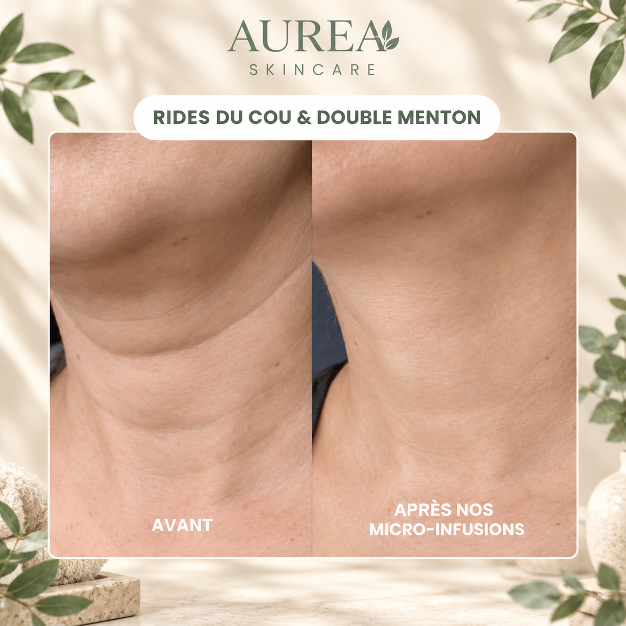 Micro-Infusion Anti-Âge